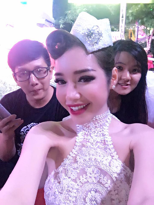 Elly Trần gây sốc với loạt ảnh cánh tay bị biến dạng