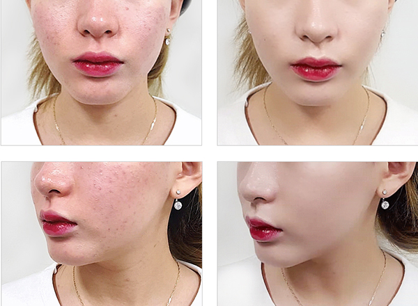 nakeup-face-phan-nuoc-che-khuyet-diem-hot-khong-kem-april-skin-7