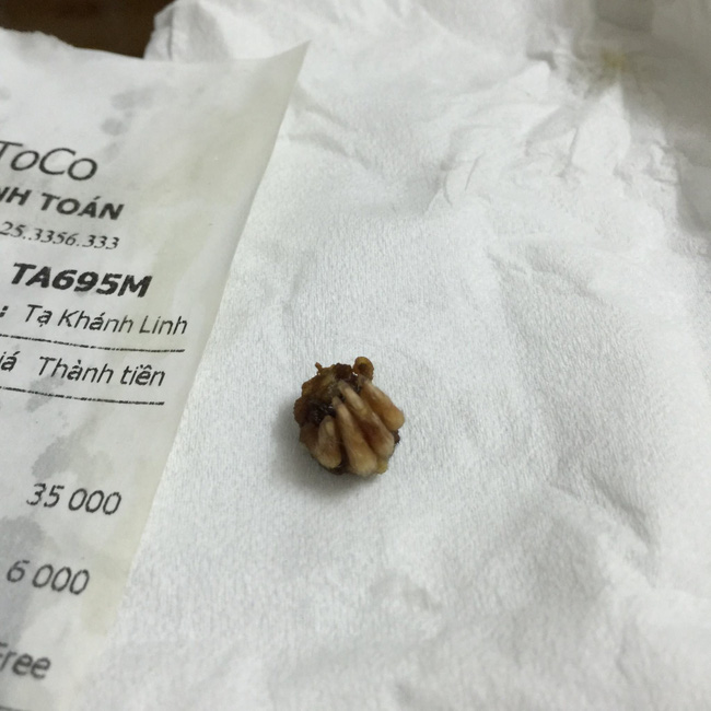 Quản lý chuỗi cửa hàng trà sữa TocoToco lên tiếng về vật thể lạ trong cốc trà sữa của hãng - Ảnh 3.