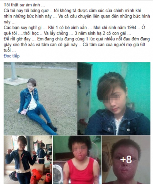 facebooker-thuong-xot-nguoi-vo-9x-bi-chong-tm-xang-dot