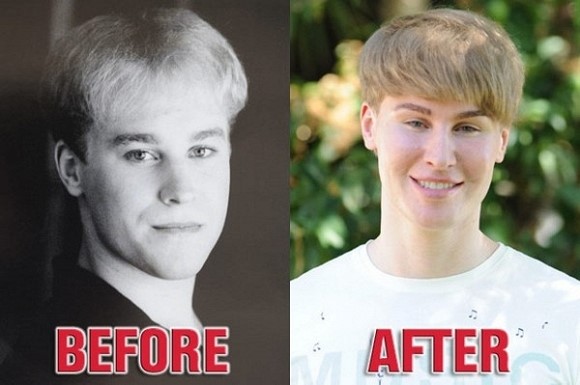 Cong bo nguyen nhan 'ban sao Justin Bieber' qua doi hinh anh 2