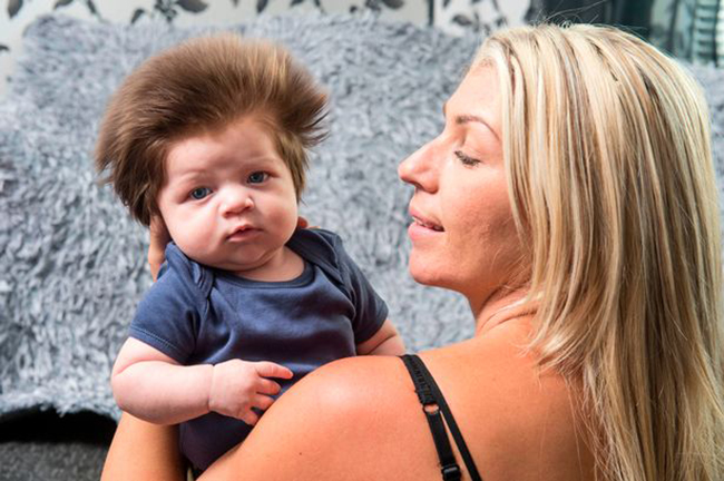 Bé trai 2 tháng tuổi đáng yêu sở hữu mái tóc điện giật bẩm sinh - Ảnh 2.