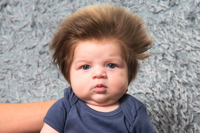 Bé trai 2 tháng tuổi đáng yêu sở hữu mái tóc điện giật bẩm sinh - Ảnh 1.