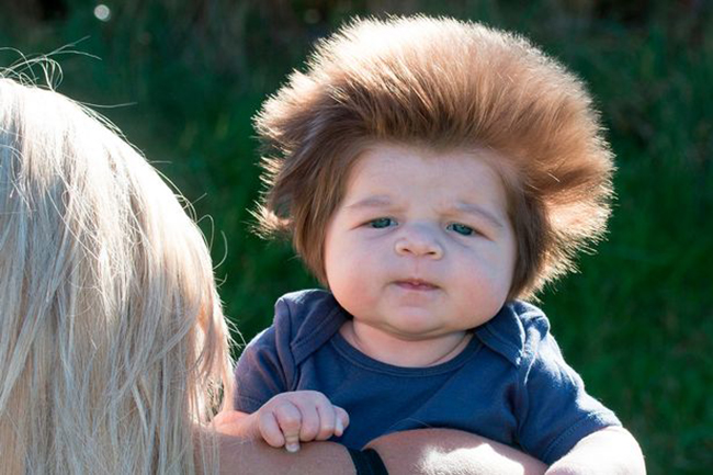 Bé trai 2 tháng tuổi đáng yêu sở hữu mái tóc điện giật bẩm sinh - Ảnh 3.