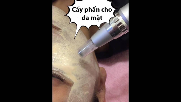 cấy phấn cho da mặt 