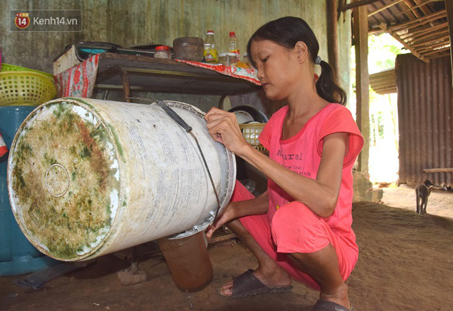 Cô gái mang khuôn mặt bà lão ở Quảng Nam ăn gấp 10 lần người bình thường, uống mỗi ngày 36 lít nước - Ảnh 7.