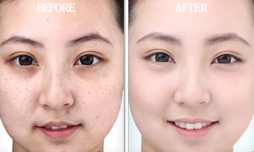 Tự làm serum vitamin C tại nhà giúp mờ thâm sáng da hiệu quả