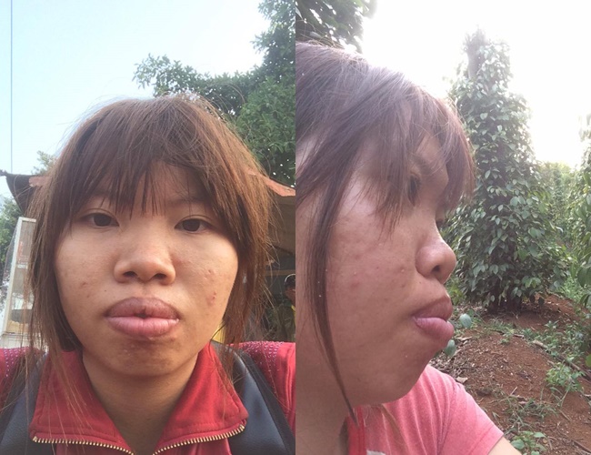 Bị bạn bè xa lánh vì ngoại hình xấu xí, bà mẹ đơn thân ở Đắk Nông quyết đập mặt làm lại - Ảnh 2.