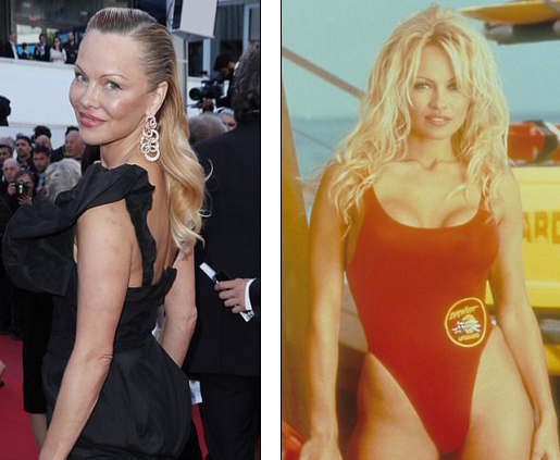  Pamela Anderson - hiện tại (trái) và quá khứ (phải) có nhiều điểm khác biệt khiến cô bị đồn lạm dụng dao kéo thẩm mỹ 