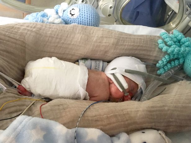 Em bé chào đời chỉ 0,5kg cùng 70 ngày chiến đấu kiên cường - Ảnh 2.
