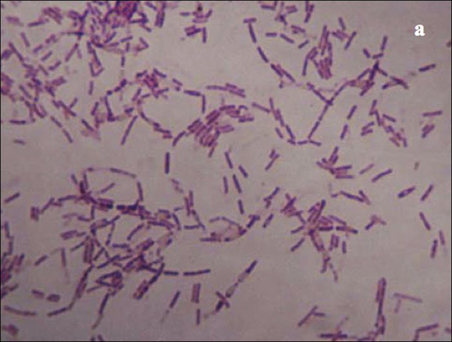  Vi khuẩn Bacillus F 