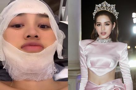 Đỗ Thị Hà băng bó khắp mặt, mới dao kéo hay gì?