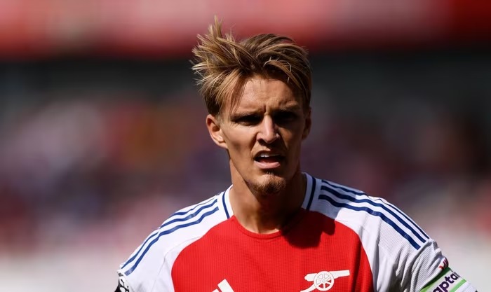 Arteta gây sốc với phát biểu sau thất bại của Arsenal trước PSG