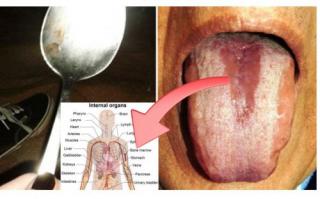 Cách phát hiện nội tạng có đang bị nhiễm độc hay không chỉ bằng 1 chiếc thìa