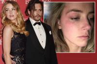 Thêm bằng chứng Amber Heard gian dối khi tố Johnny Depp bạo hành