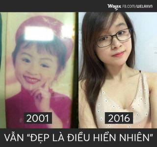 Trào lưu Before - After: Bạn có tự tin mình  Vẫn... xinh tươi từ bé đến nay? 