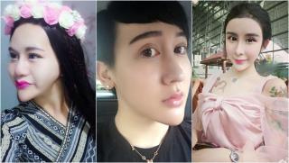 5 ca tự chỉnh mặt nhọn, kéo dài tay chân đến dị dạng để nổi tiếng