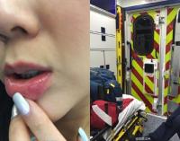 Vợ chồng  Đoàn Dự  bị chỉ trích vì bỏng môi gọi xe cấp cứu