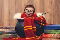 Bé gái 3 tháng tuổi được mệnh danh Harry Potter nhí