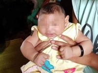Việt Nam xác nhận em bé đầu tiên bị teo não do virus Zika