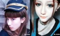 Khuôn mặt bị chê  thảm họa dao kéo  của cô gái Trung Quốc