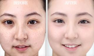 Tự làm serum vitamin C tại nhà giúp mờ thâm sáng da hiệu quả