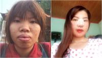 Bị bạn bè xa lánh vì ngoại hình xấu xí, bà mẹ đơn thân ở Đắk Nông quyết  đập mặt làm lại 