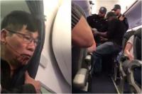 Bác sĩ gốc Việt bị lôi khỏi máy bay United Airlines