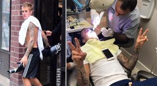 Justin Bieber bị sứt răng vì tập quyền anh