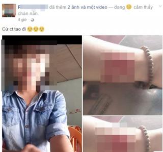 Nữ sinh quay clip rạch tay: Lụy tình hay làm màu đều đáng trách