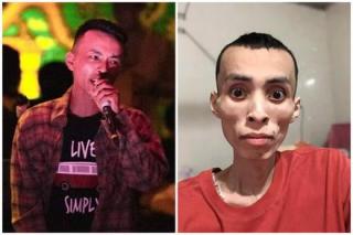 Nam rapper Việt ung thư qua đời ở tuổi 27, đau lòng hình ảnh cuối